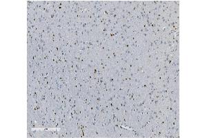 IHC analysis of Transketolase/TKT using anti-Transketolase/TKT antibody (ABIN7598959). (TKT antibody  (AA 1-116))