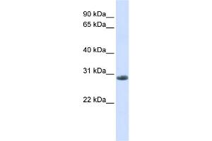 WB Suggested Anti-YIPF6 Antibody Titration:  0. (YIPF6 antibody  (C-Term))