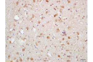 Formalin-fixed and paraffin embedded rat brain labeled with Rabbit Anti-AKT1/2/3 (Thr305/308/309) Polyclonal Antibody, Unconjugated (ABIN756052) at 1:200 followed by conjugation to the secondary antibody and DAB staining (AKT 1/2/3 antibody  (pThr305, pThr308, pThr309))