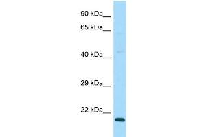 WB Suggested Anti-DAND5 Antibody Titration: 1. (DAND5 antibody  (C-Term))