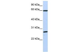 DNAJC1 antibody used at 1 ug/ml to detect target protein.