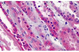 Human Kidney: Formalin-Fixed, Paraffin-Embedded (FFPE) (TRAF5 antibody  (AA 77-186))