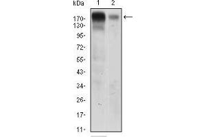Western blot analysis using EGFR mouse mAb against A431 (1) AND Hela (2) cell lysate. (EGFR antibody  (AA 693-893))