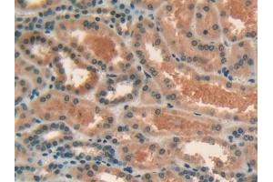 Immunohistochemistry (IHC) image for anti-Lipase, Endothelial (LIPG) (AA 175-412) antibody (ABIN7429361)