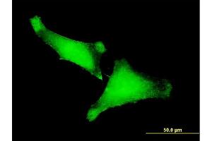 Immunofluorescence of monoclonal antibody to ZNF175 on HeLa cell. (ZNF175 antibody  (AA 81-178))