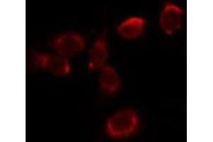 ABIN6278025 staining HepG2 by IF/ICC. (Hemoglobin Alpha 1 + 2 (HBA1,HBA2) (Internal Region) antibody)
