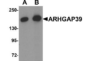 Western blot analysis of ARHGAP39 in A20 cell lysate with ARHGAP39 antibody at (A) 1 and (B) 2 µg/mL (ARHGAP39 antibody  (C-Term))