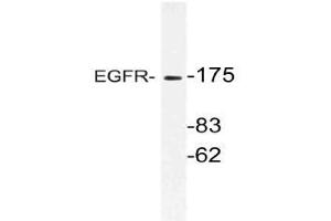 Western blot (WB) analysis of EGFR antibody in extracts from HeLa cells. (EGFR antibody)