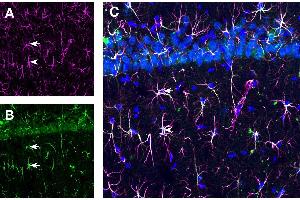 Expression of GFAP and TSH Receptor in rat hippocampus CA1 region. (GFAP antibody  (Intracellular) (Atto 647N))