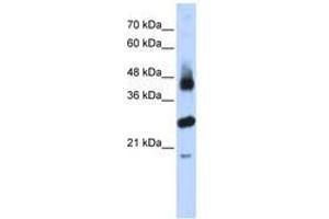 Image no. 1 for anti-F-Box and Leucine-Rich Repeat Protein 2 (FBXL2) (AA 71-120) antibody (ABIN6740795) (FBXL2 antibody  (AA 71-120))