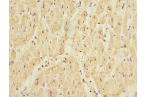Immunohistochemistry of paraffin-embedded human heart tissue using ABIN7169860 at dilution of 1:100 (SMPX antibody  (AA 1-88))