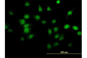 Immunofluorescence of monoclonal antibody to PDE6D on HeLa cell. (PDE6D antibody  (AA 1-150))