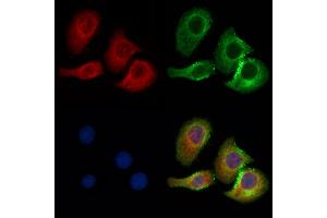 ABIN7094458 and ABIN7098506 staining Hela cells by IF/ICC. (CBX7 antibody  (N-Term))