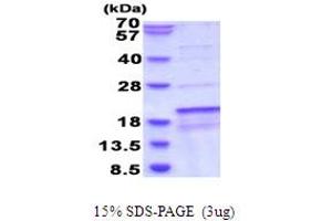 SDS-PAGE (SDS) image for Succinate Dehydrogenase Complex Assembly Factor 1 (SDHAF1) (AA 1-115) protein (His tag) (ABIN5853965) (SDHAF1 Protein (AA 1-115) (His tag))