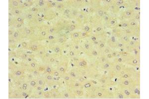 Immunohistochemistry of paraffin-embedded human liver tissue using ABIN7149254 at dilution of 1:100 (CYP2J2 antibody  (AA 328-502))