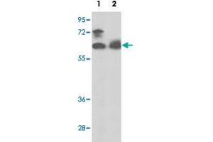 Western blot analysis of PANK1 polyclonal antibody  in MCF-7 cell line (Lane 1) and mouse spleen tissue lysates (Lane 2)(35 ug/lane). (PANK1 antibody  (N-Term))