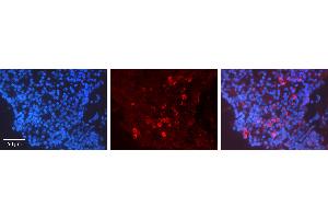 Rabbit Anti-CCNA2 Antibody   Formalin Fixed Paraffin Embedded Tissue: Human Lymph Node Tissue Observed Staining: Cytoplasm Primary Antibody Concentration: 1:600 Other Working Concentrations: N/A Secondary Antibody: Donkey anti-Rabbit-Cy3 Secondary Antibody Concentration: 1:200 Magnification: 20X Exposure Time: 0. (Cyclin A antibody  (C-Term))