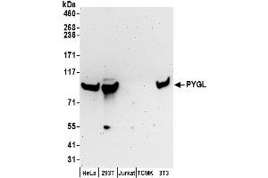 Western Blotting (WB) image for anti-phosphorylase, Glycogen, Liver (PYGL) (AA 797-847) antibody (ABIN7450622)