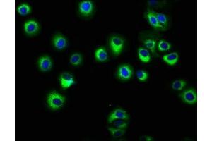 Immunofluorescence staining of HepG2 cells with ABIN7155571 at 1:166, counter-stained with DAPI. (HLA-C antibody  (AA 62-306))