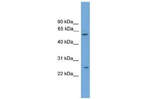 WB Suggested Anti-POT1 Antibody Titration: 0. (POT1 antibody  (Middle Region))