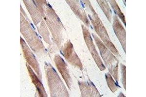 Immunohistochemistry (IHC) image for anti-Desmin (DES) (AA 1-30) antibody (ABIN3030717)
