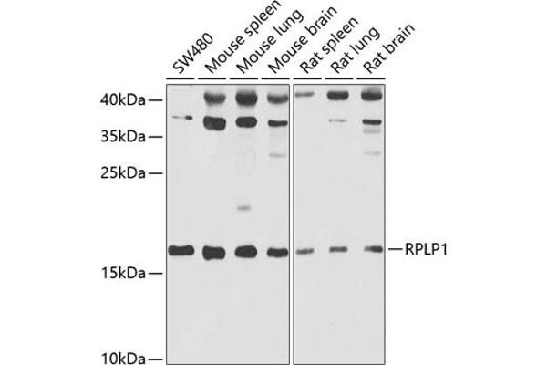 RPLP1 antibody  (AA 1-114)