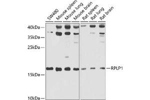 Western blot analysis of extracts of various cell lines, using RPLP1 antibody (ABIN6129657, ABIN6147166, ABIN6147167 and ABIN6222445) at 1:1000 dilution.