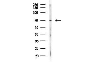Western blot analysis of lysates from Rat brain, using ATP6V1A Antibody at 1/1000 dilution.