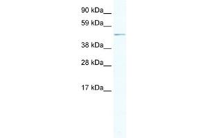 WB Suggested Anti-ARX Antibody Titration:  2. (Arx antibody  (Middle Region))