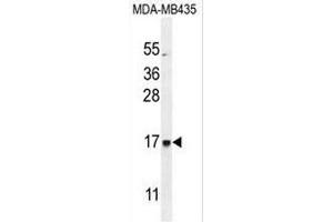 Western Blotting (WB) image for anti-Eukaryotic Translation Initiation Factor 3 Subunit A (EIF3A) (AA 172-202), (C-Term) antibody (ABIN952046)