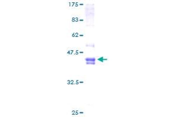 FOSL2 Protein (AA 1-122) (GST tag)