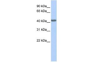 CCR2 antibody used at 1 ug/ml to detect target protein. (CCR2 antibody)
