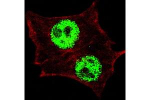 Fluorescent confocal image of HeLa cells stained with (ABIN390035 and ABIN2839785) Phospho-KLF4- antibody. (KLF4 antibody  (pSer254))