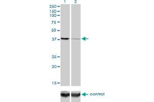 Western blot analysis of EIF2C2 over-expressed 293 cell line, cotransfected with EIF2C2 Validated Chimera RNAi (Lane 2) or non-transfected control (Lane 1). (AGO2 antibody  (AA 1-377))