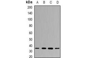 Western blot analysis of PPX expression in MCF7 (A), NIH3T3 (B), mouse testis (C), mouse spleen (D) whole cell lysates. (PPP4C antibody)