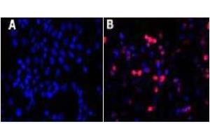 Immunofluorescence (IF) image for anti-His Tag antibody (ABIN1105141) (His Tag antibody)