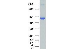 Western Blotting (WB) image for Calcium/calmodulin-Dependent Protein Kinase Kinase 1, alpha (CAMKK1) (Transcript Variant 1) protein (Myc-DYKDDDDK Tag) (ABIN2713097)