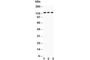 Western blot testing of PLD1 antibody and Lane 1:  mouse heart (PLD1 antibody  (AA 1-330))
