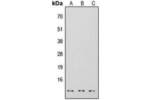 Western blot analysis of S100-A7 expression in HEK293T (A), NS-1 (B), H9C2 (C) whole cell lysates.