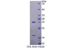 SDS-PAGE (SDS) image for Endothelin Converting Enzyme 2 (ECE2) (AA 1-163) protein (His tag) (ABIN6239590)