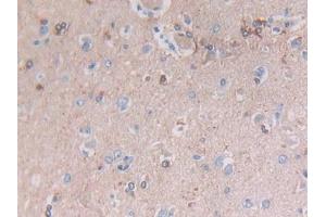 Detection of GFAP in Human Cerebrum Tissue using Polyclonal Antibody to Glial Fibrillary Acidic Protein (GFAP) (GFAP antibody  (AA 256-357))