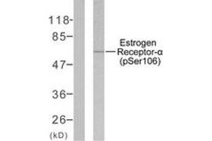 Western blot analysis of extracts from MCF7 cells, using Estrogen Receptor-alpha (Phospho-Ser106) Antibody. (Estrogen Receptor alpha antibody  (pSer106))