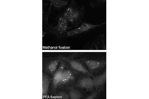 Immunofluorescence staining of SQSTM1 polyclonal antibody  on Methanol-fixed and PFA fixed HeLa cells. (SQSTM1 antibody  (C-Term))