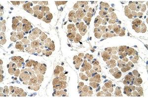 Immunohistochemical staining (Formalin-fixed paraffin-embedded sections) of human muscle with KLHL31 polyclonal antibody . (KLHL31 antibody  (AA 501-550))