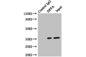 Immunoprecipitating DFFA in Hela whole cell lysate Lane 1: Rabbit control IgG instead of (1 μg) instead of ABIN7150176 in Hela whole cell lysate. (DFFA antibody  (AA 1-331))