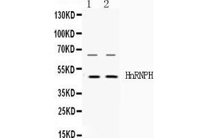 Western blot analysis of HnRNP H expression in HELA whole cell lysates ( Lane 1) and HEPG2 whole cell lysates ( Lane 2). (HNRNPH1 antibody  (N-Term))
