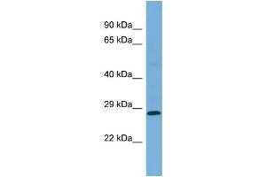 Western Blotting (WB) image for anti-Mediator Complex Subunit 19 (MED19) (Middle Region) antibody (ABIN2786282)
