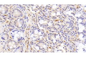 Detection of ACVA in Human Small intestine Tissue using Polyclonal Antibody to Activin A (ACVA) (ACVA antibody  (AA 44-178))