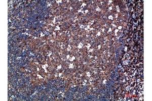 Immunohistochemical analysis of paraffin-embedded human-tonsil, antibody was diluted at 1:200 (TPSD1 antibody  (AA 51-100))