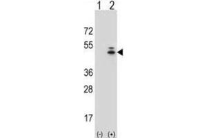 Western Blotting (WB) image for anti-Actin, gamma 1 (ACTG1) antibody (ABIN3002670) (Actin, gamma 1 antibody)